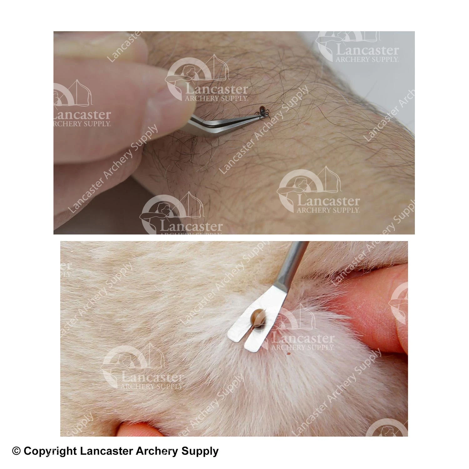 TickEase Tick Remover Tool 4 TickEase Tick Remover Tool - Image 2